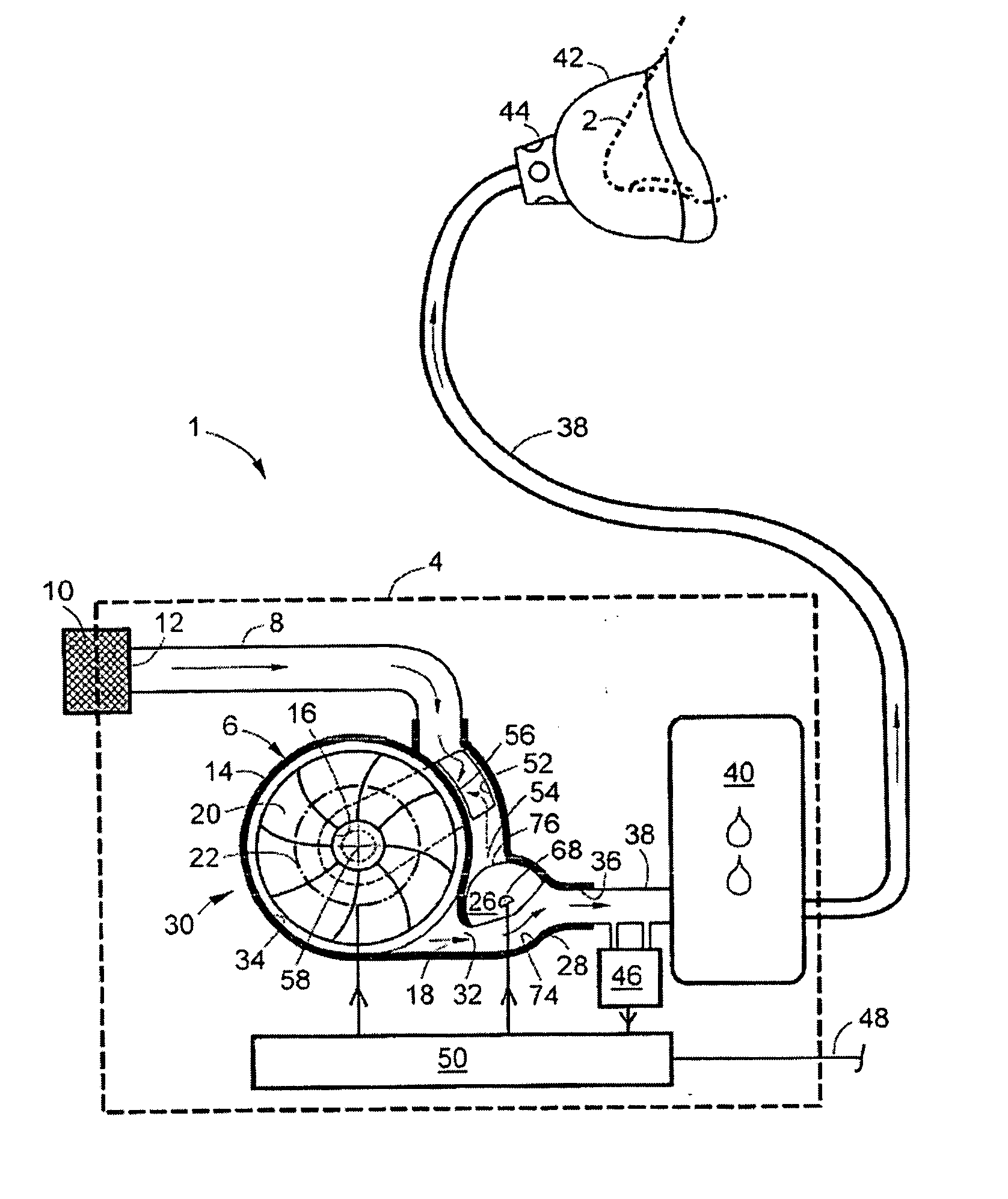 Combined gas flow generator & control valve housing in a ventilator
