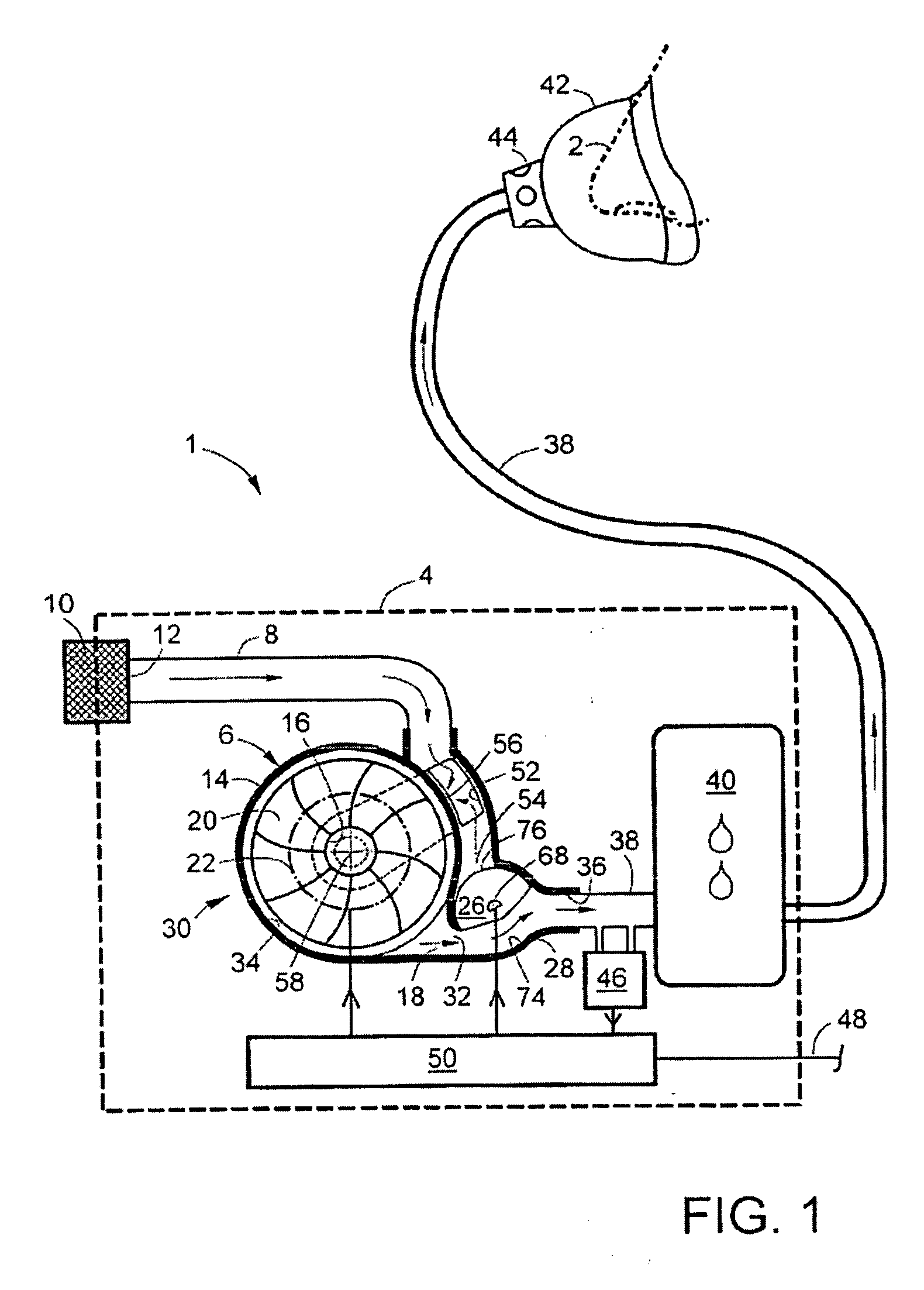 Combined gas flow generator & control valve housing in a ventilator