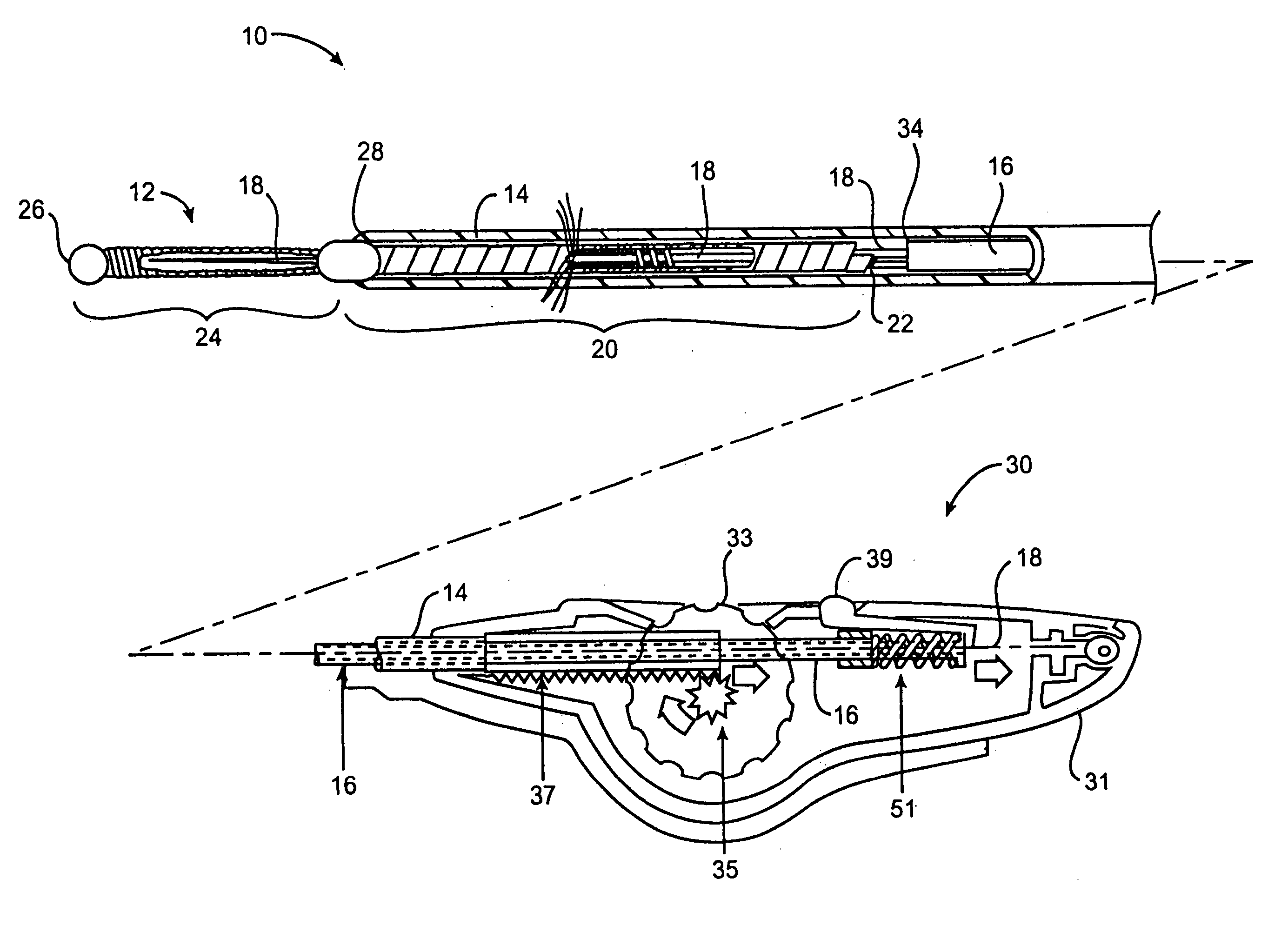 Deployment actuation system for intrafallopian contraception
