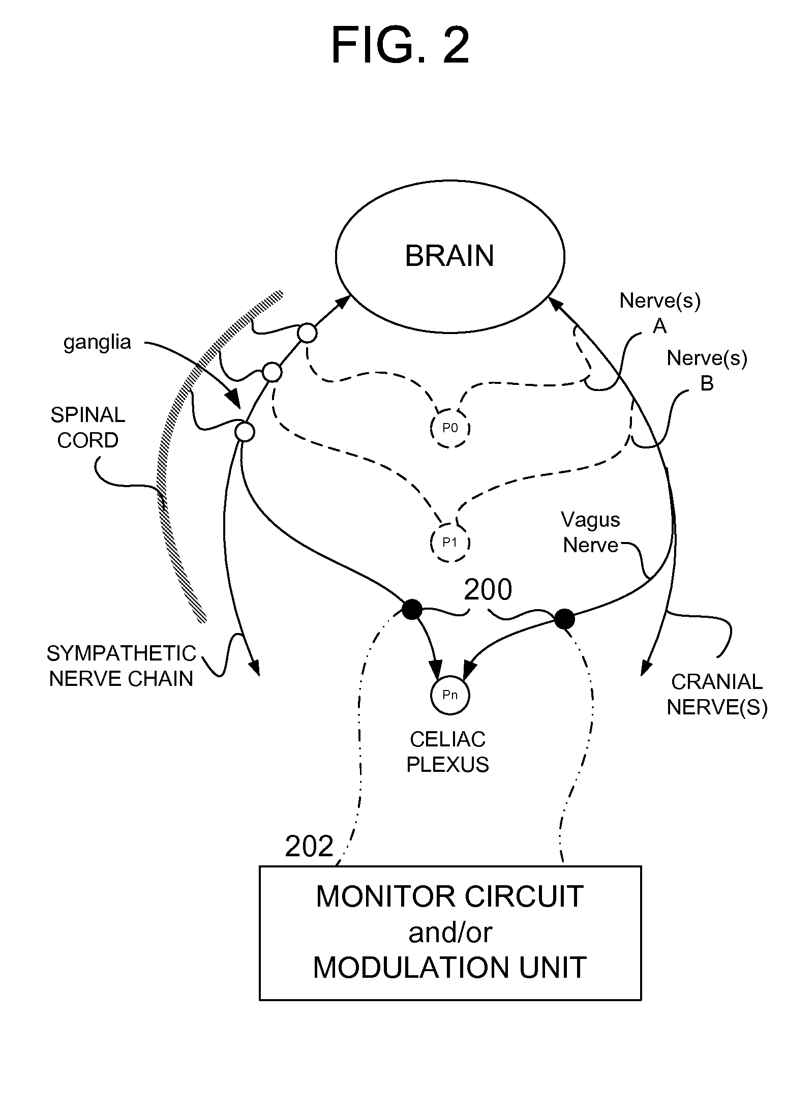 Methods And Apparatus For Treating Disorders Through Neurological And/Or Muscular Intervention