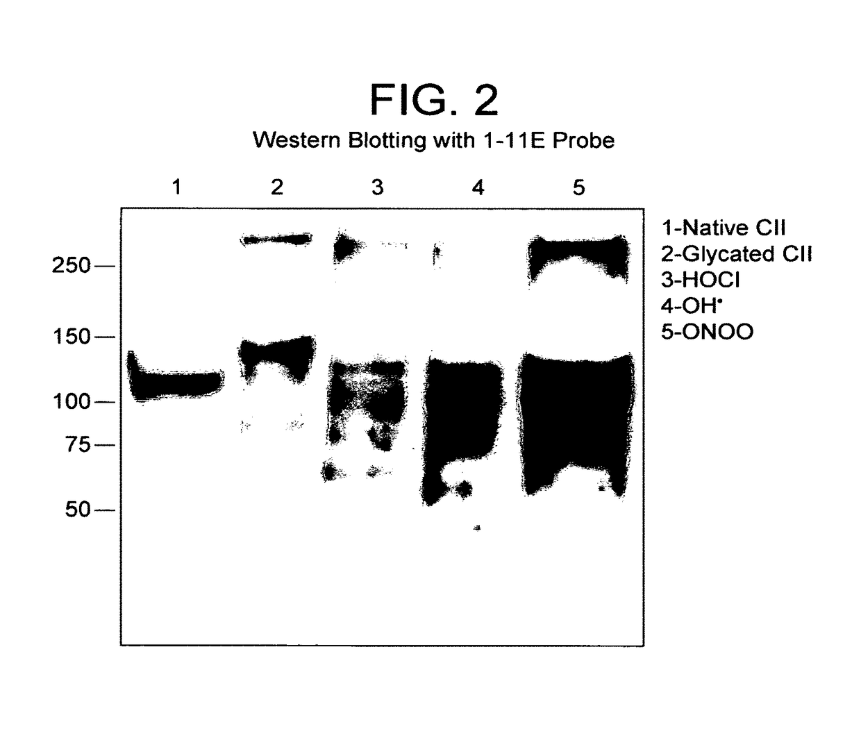 Antibody and use in diagnosis and therapy of arthropathies