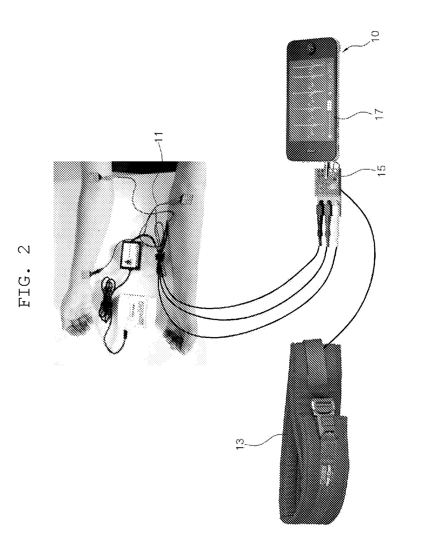 System and method for assessing treatment effects on obstructive sleep apnea