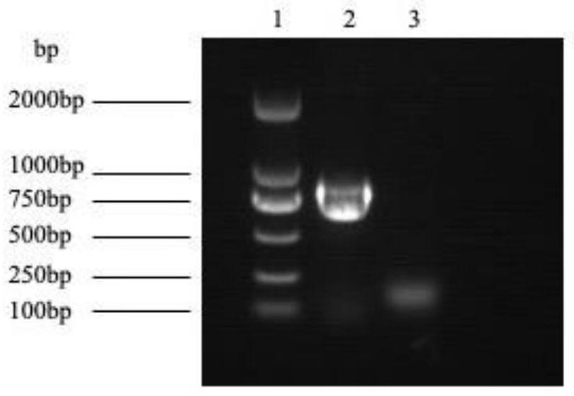 Gene for coding recombinant NlpC/P60 endopeptidase protein and application thereof