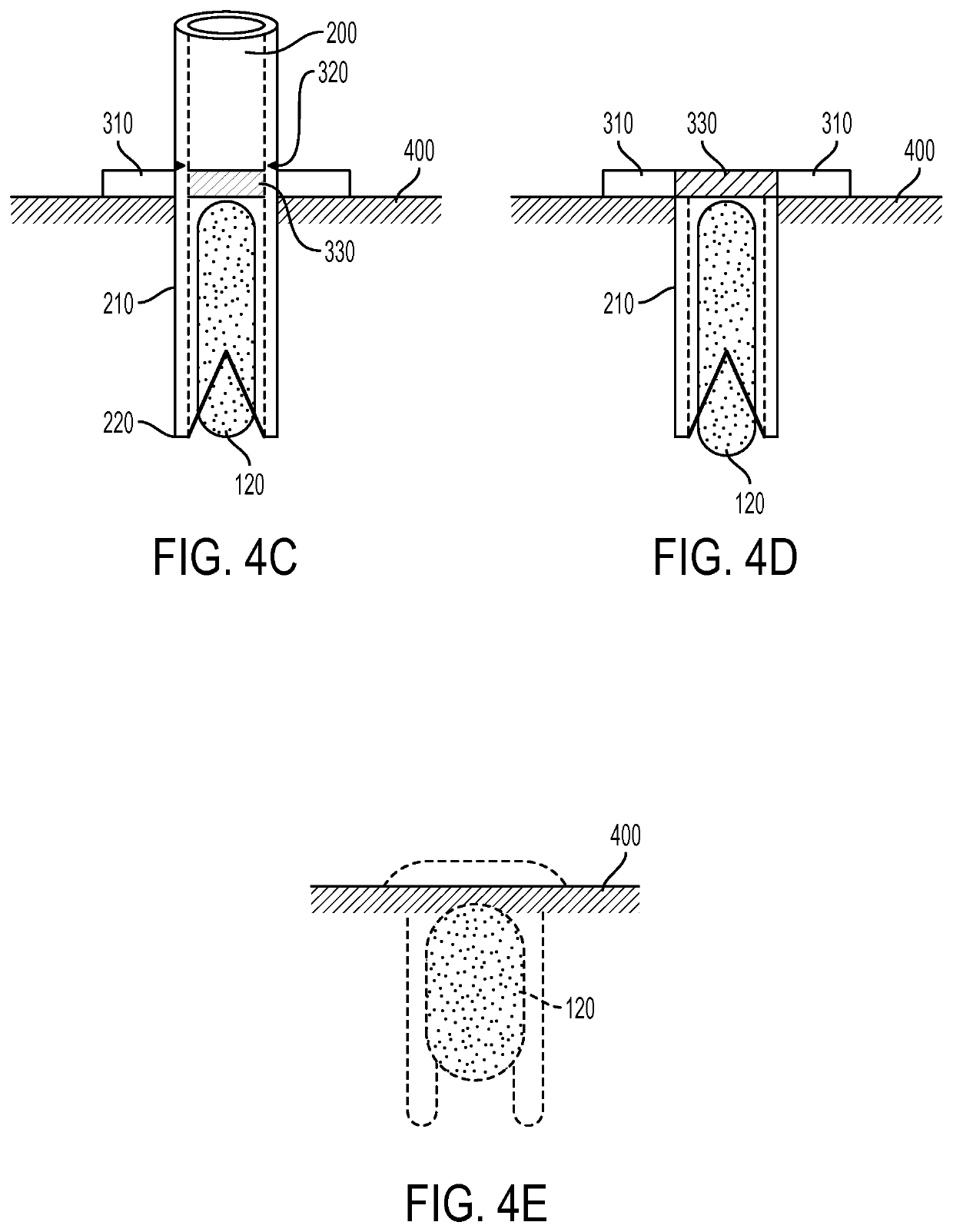 Method and apparatus for tissue copying and grafting