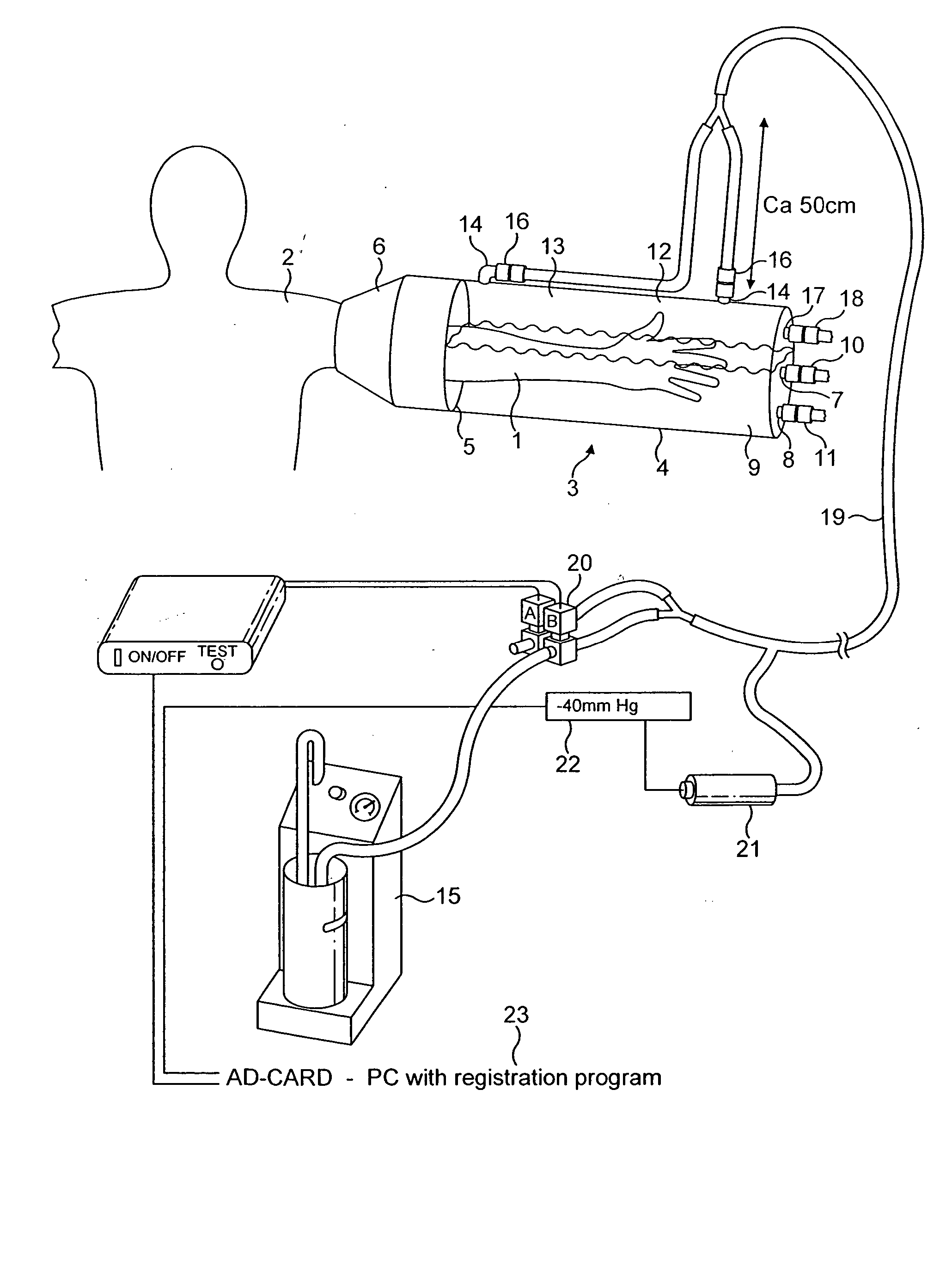 Device for applying a pulsating pressure to a local region of the body and applications thereof