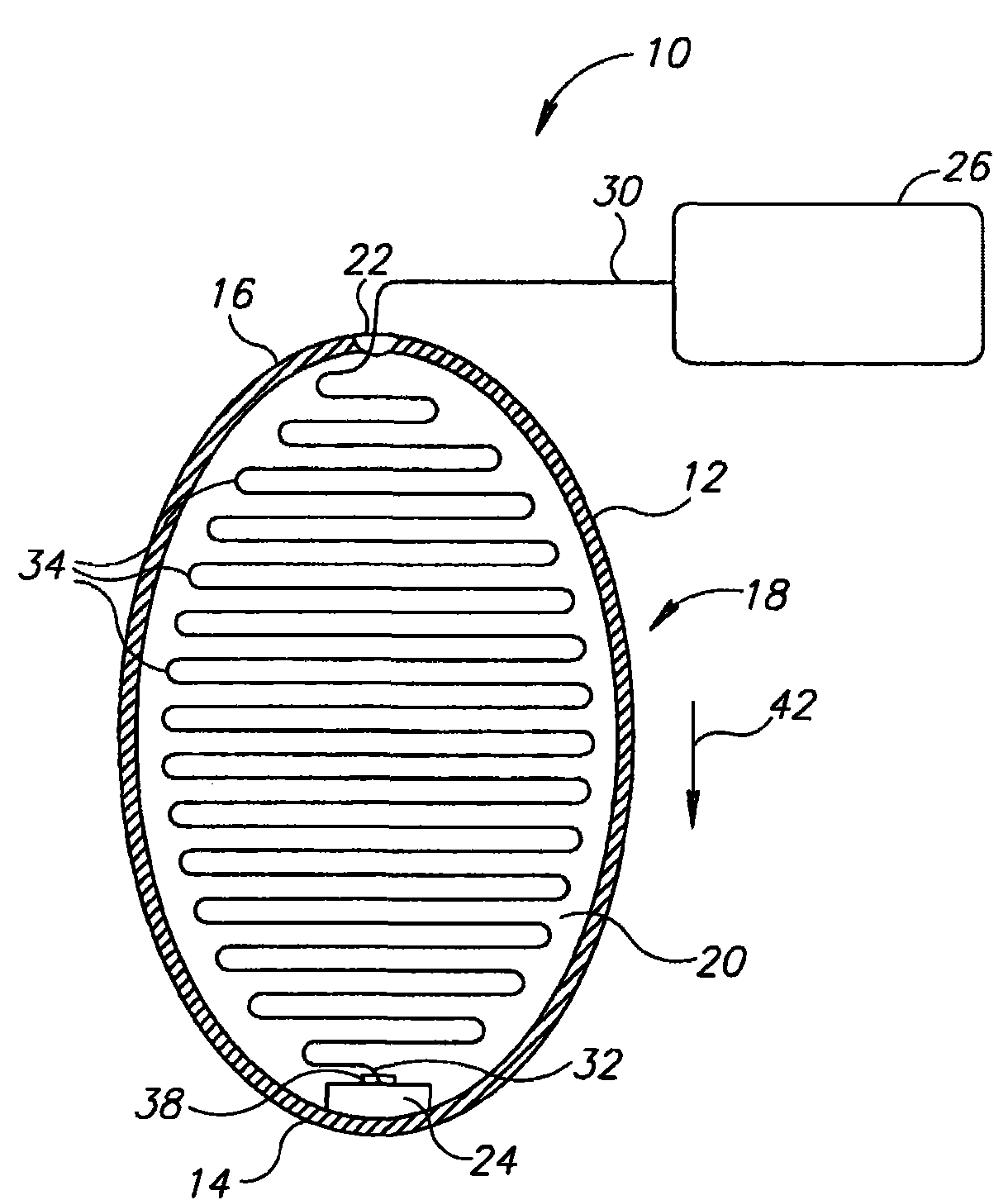 System and method for guiding of gastrointestinal device through the gastrointestinal tract