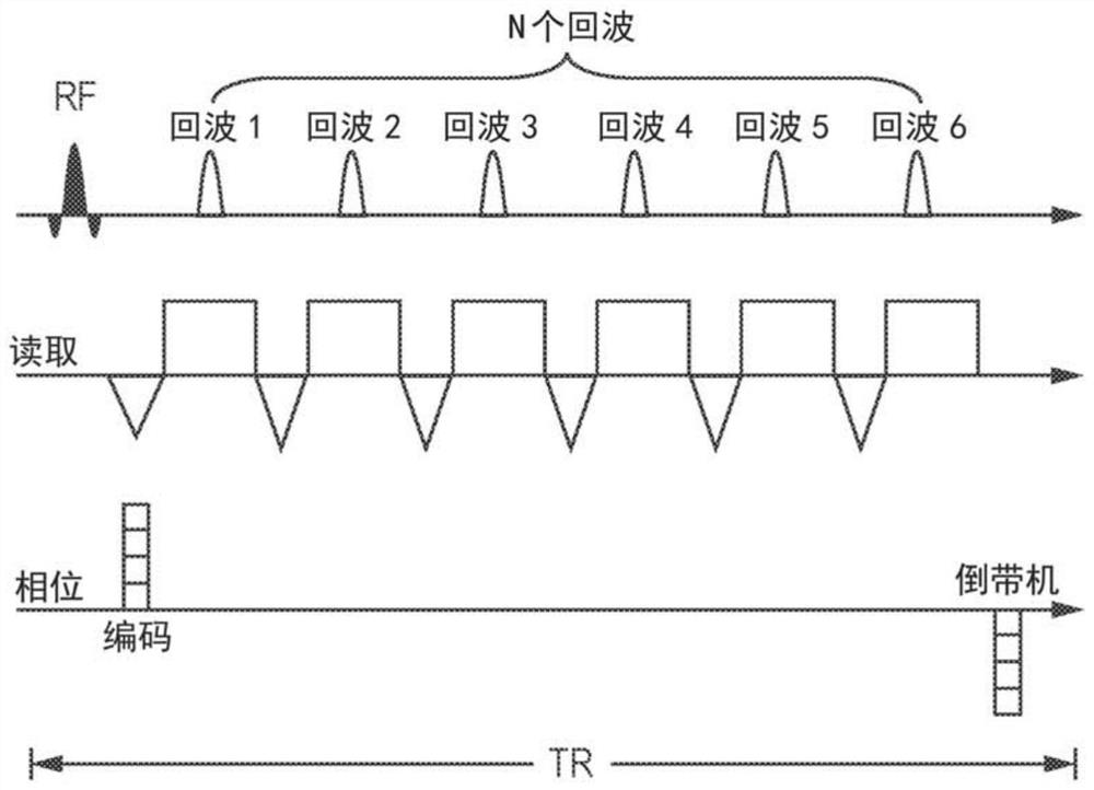 Accelerated magnetic resonance thermometry