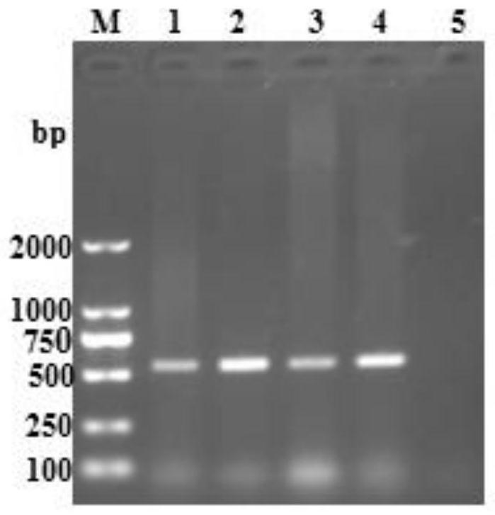 IFA neutralizing antibody detection method of PRRSV