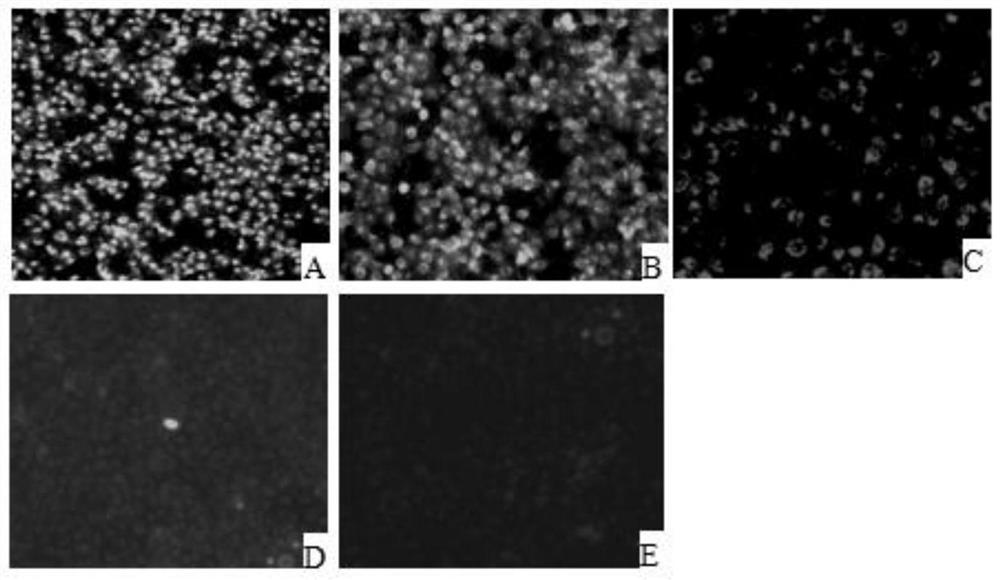 IFA neutralizing antibody detection method of PRRSV