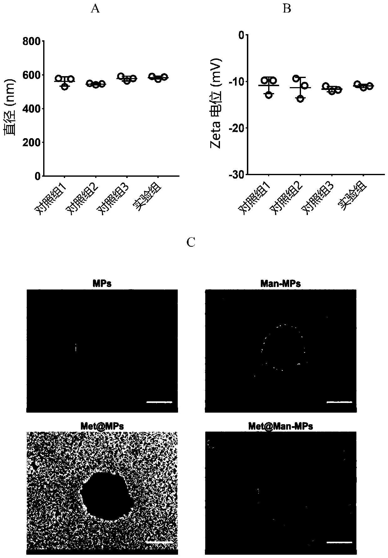Macrophage drug-loaded MP (microparticle) preparation and preparation method thereof