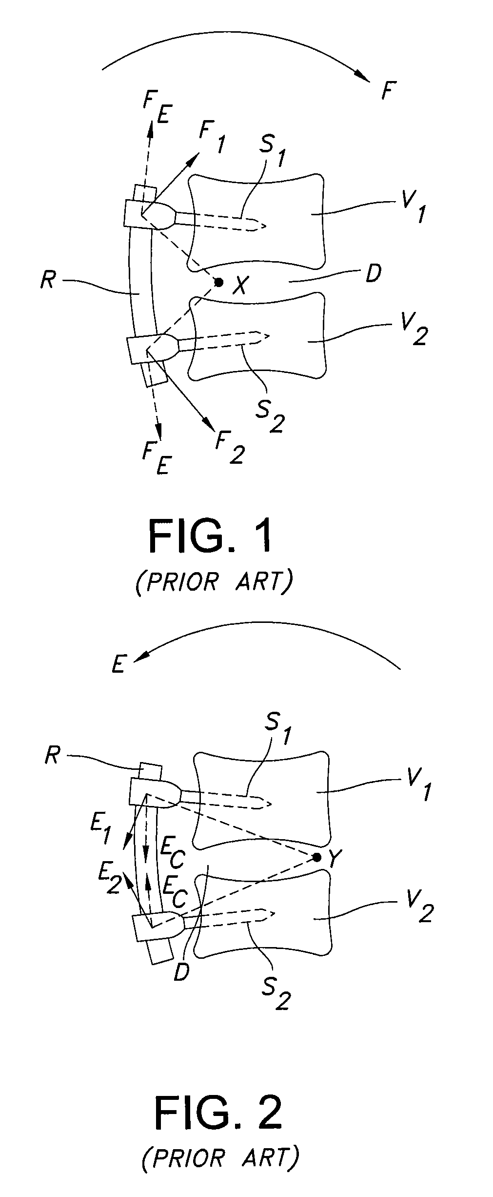 Rod assembly for dynamic posterior stabilization