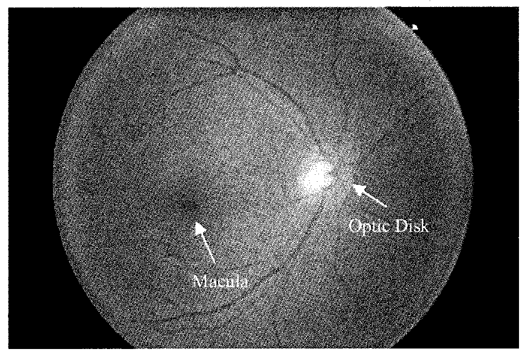 Methods and systems for assessing retinal images, and obtaining information from retinal images