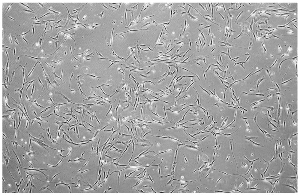Method for preparing human adipose-derived stem cell membrane based on warm dish