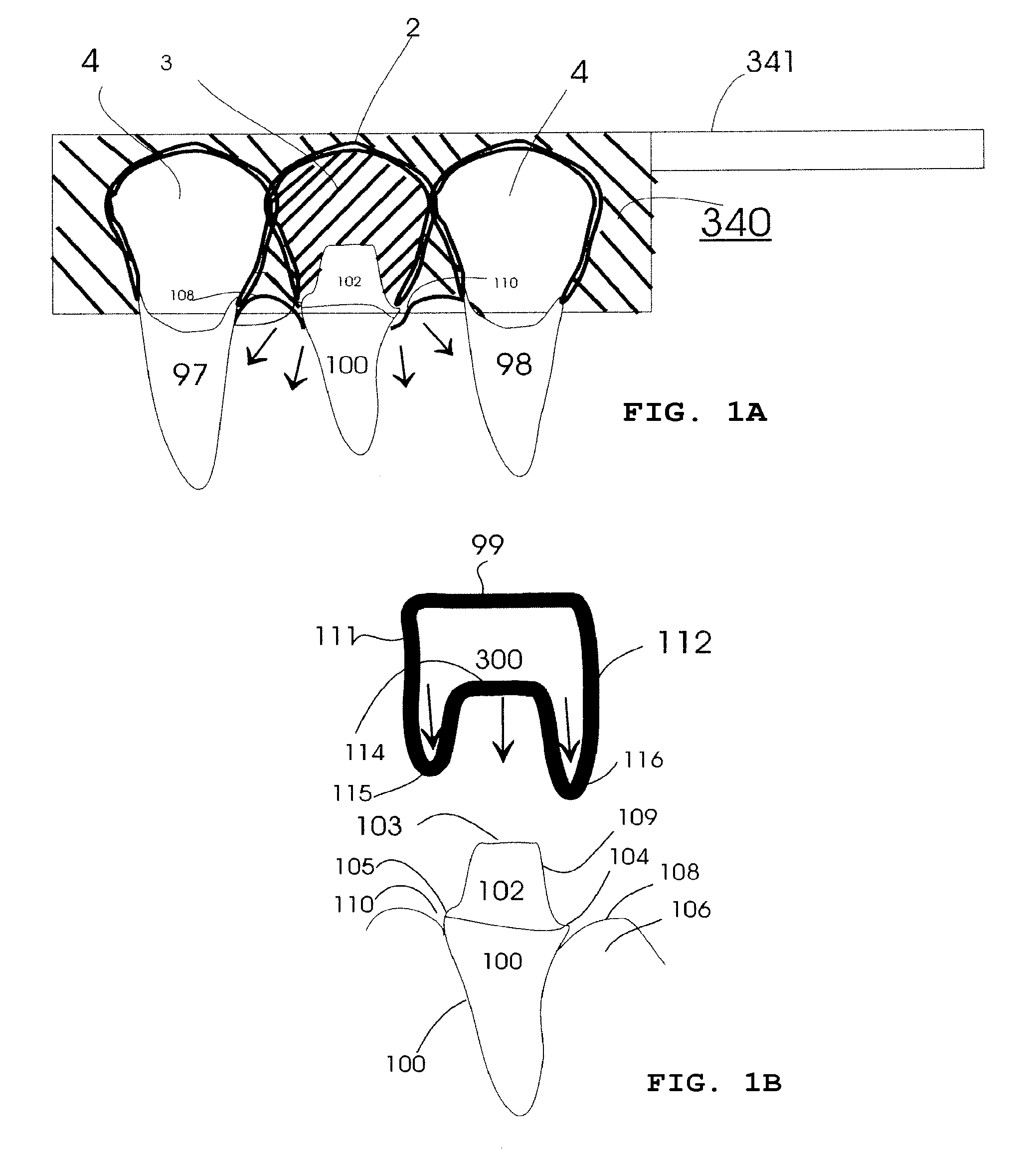 Custom impression coping and methods of manufacture and use thereof