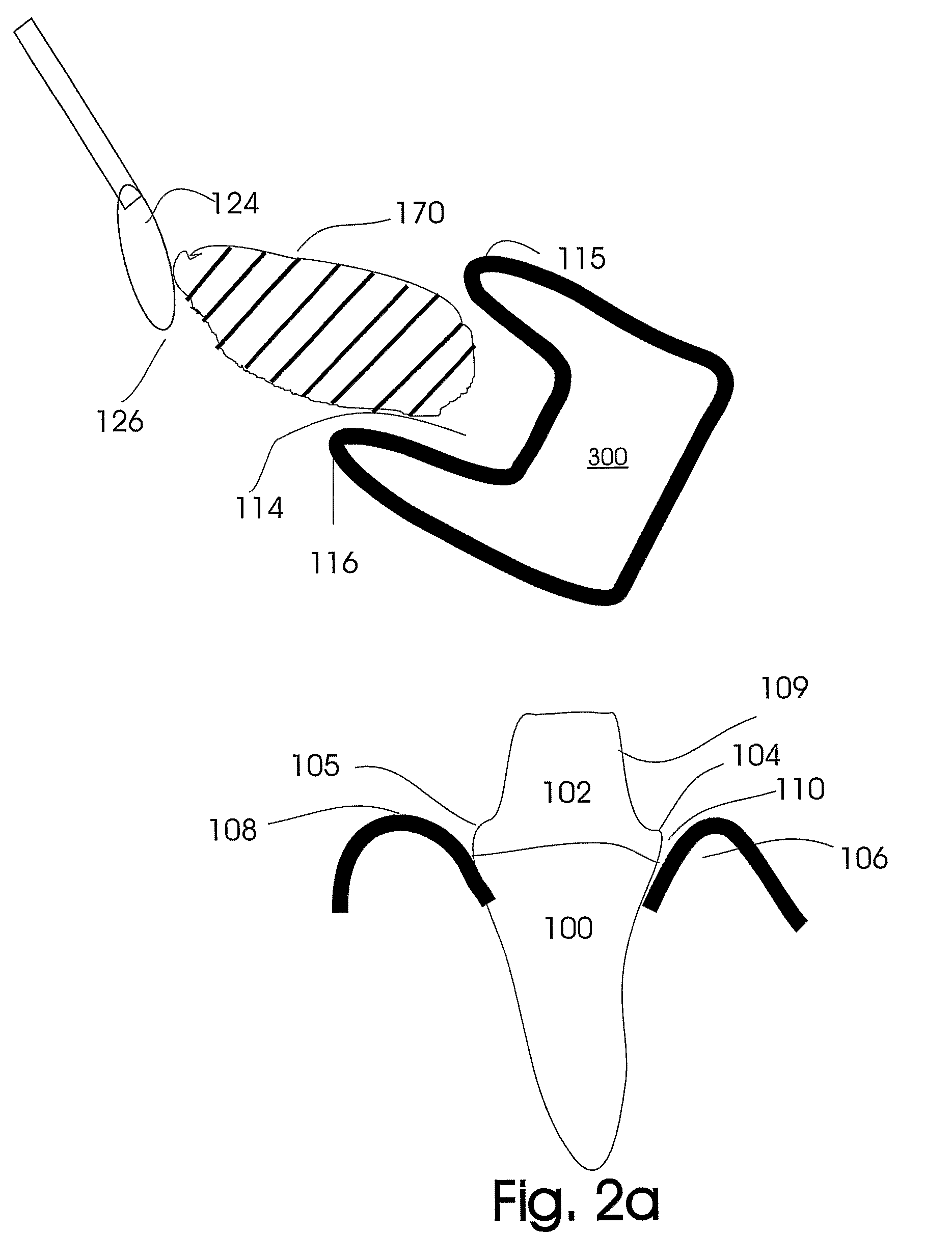 Custom impression coping and methods of manufacture and use thereof