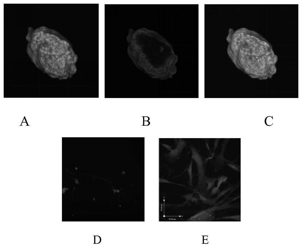 A special culture medium for lung tumor organoids and a scaffold-free 3D culture method