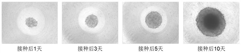 A special culture medium for lung tumor organoids and a scaffold-free 3D culture method