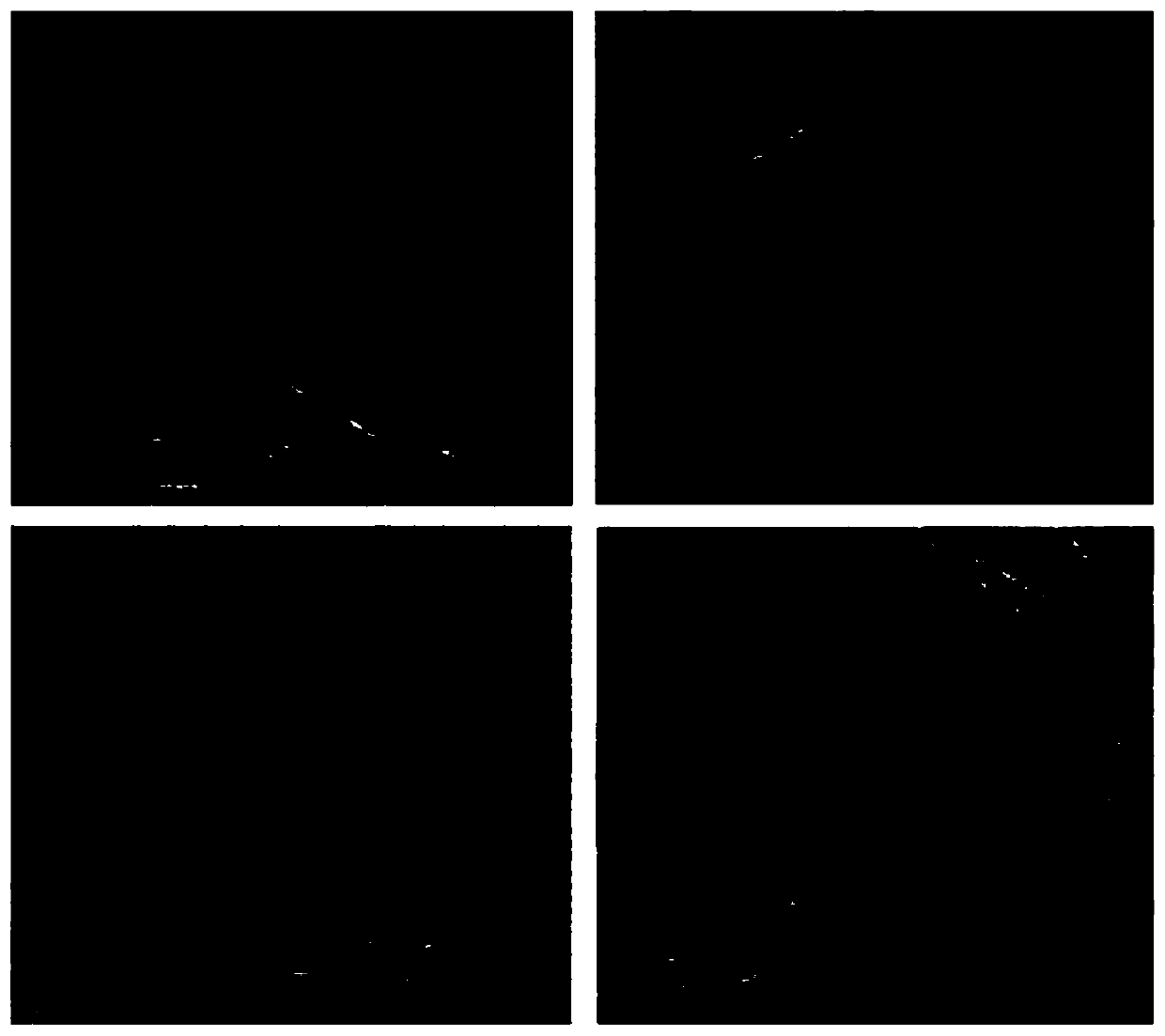 Preparation method and application of a hydroxyapatite nano oral system grafted with insulin and gallic acid