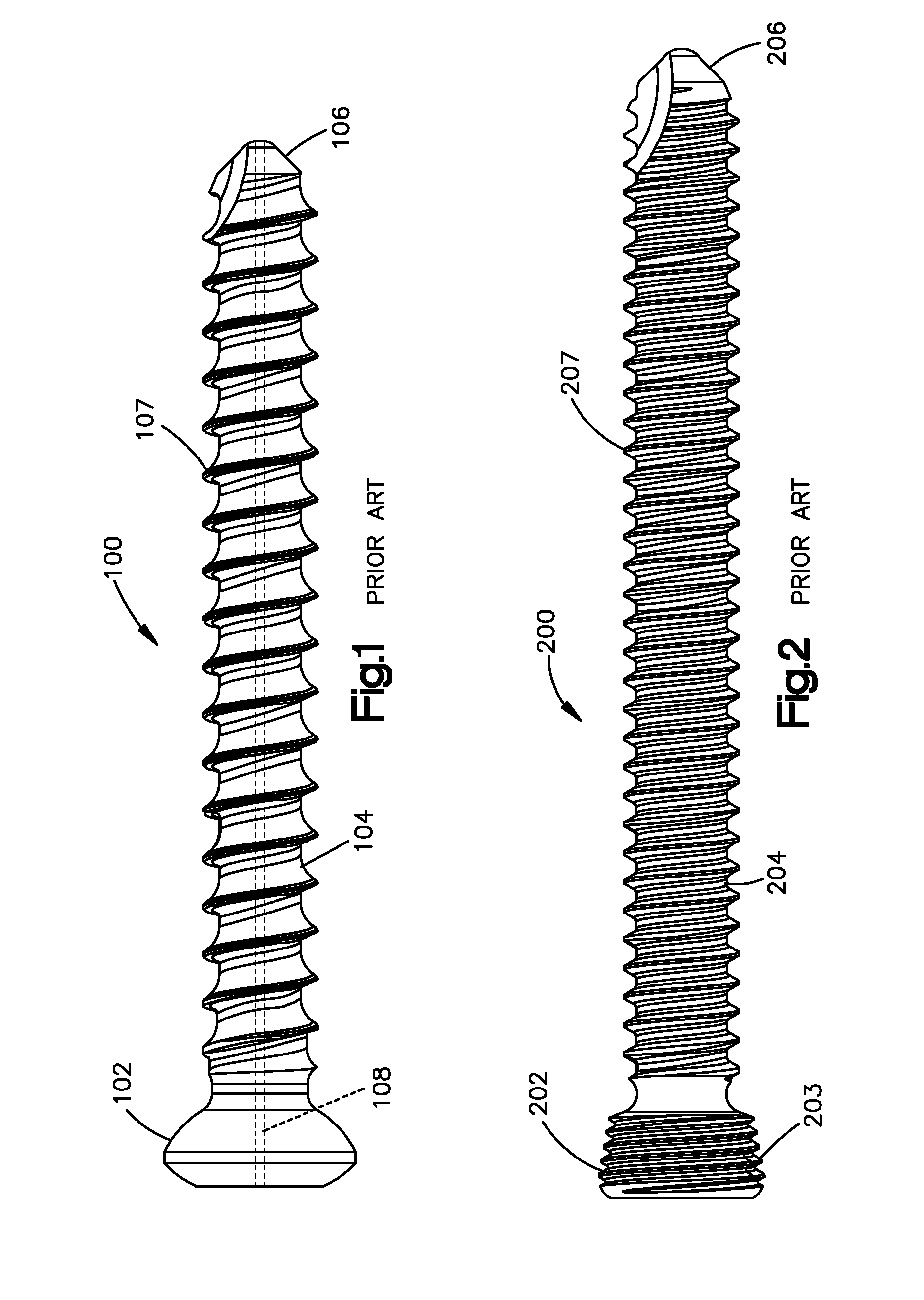 Highly-Versatile Variable-Angle Bone Plate System