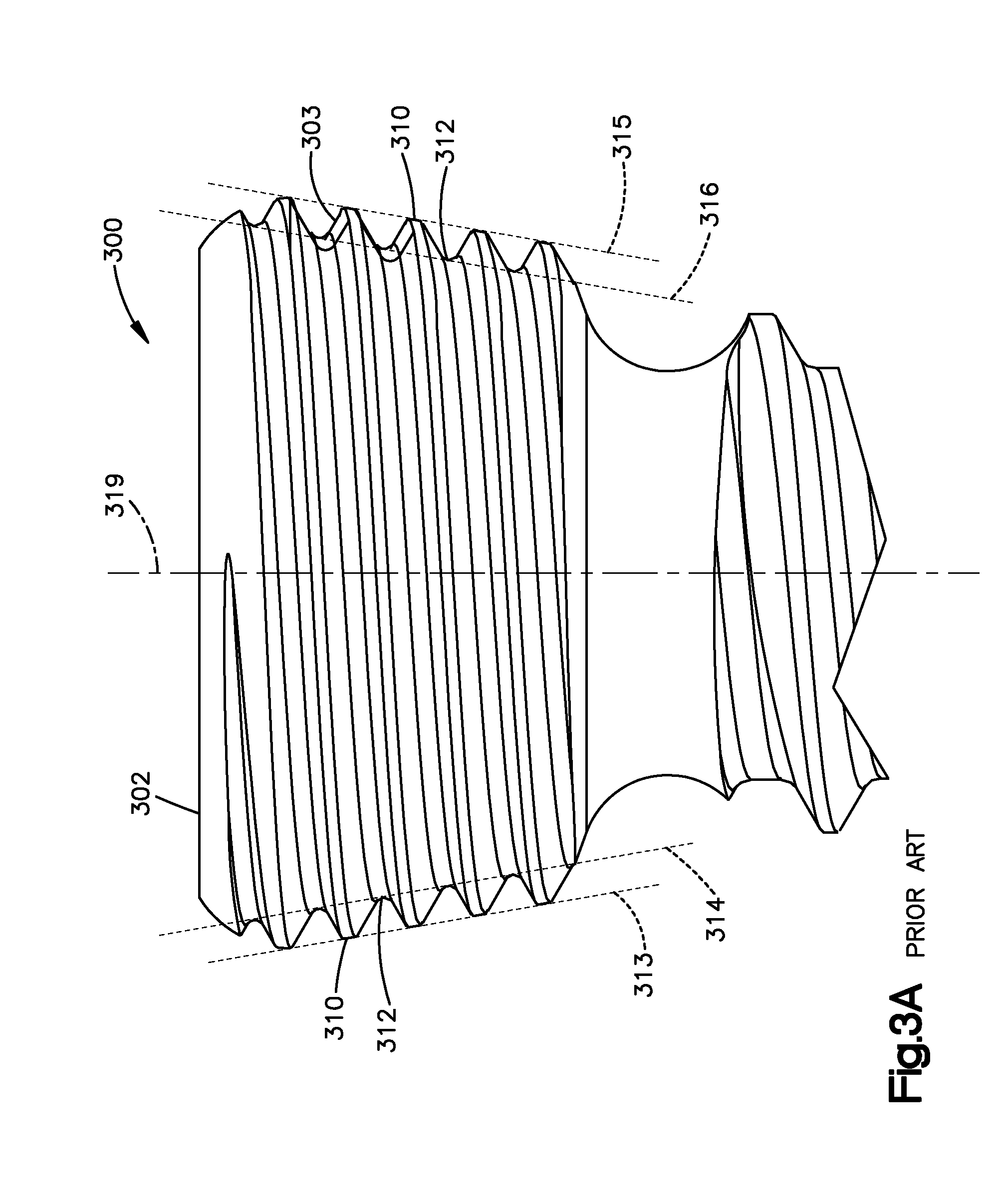 Highly-Versatile Variable-Angle Bone Plate System