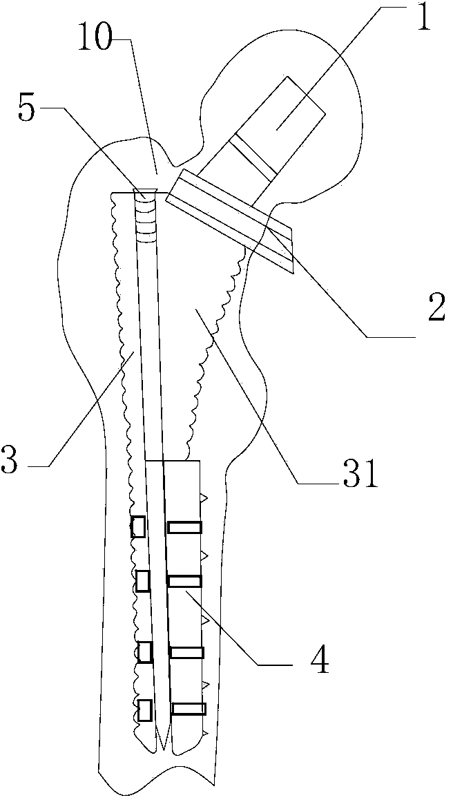 Biotype artificial hip joint femoral component