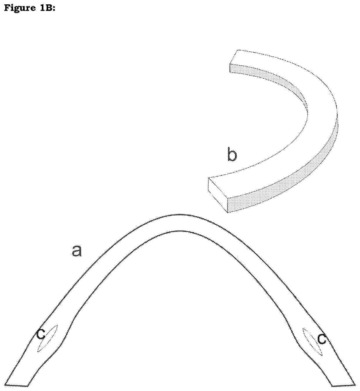 Shaped corneal segments: corneal allogenic intra-stromal devices (ring segments and rings, modified discs, modifications) for inducing shape change, regularization and stabilization of cornea in corneal ectasia and other corneal conditioins and for correction of refractive errors