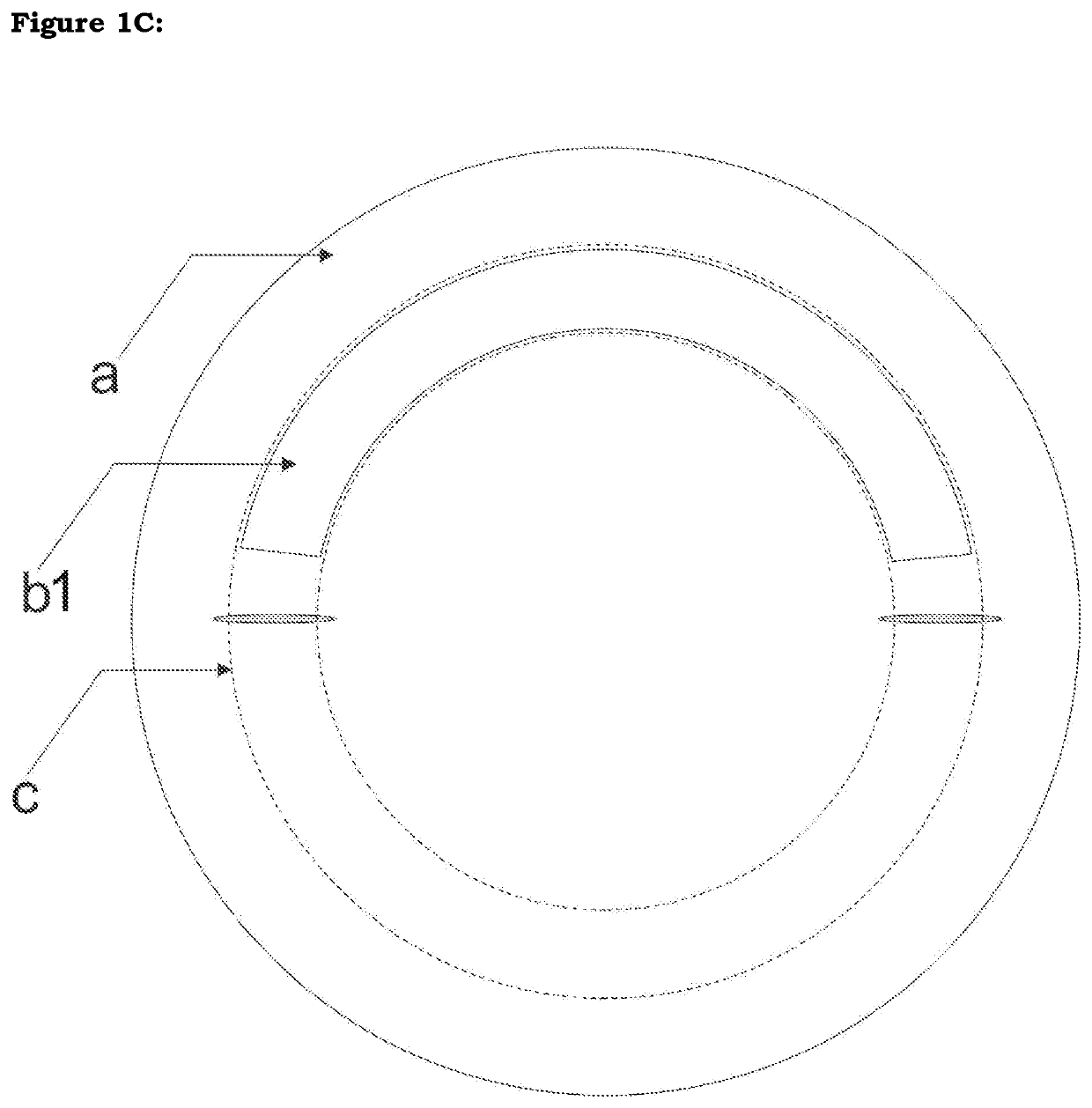Shaped corneal segments: corneal allogenic intra-stromal devices (ring segments and rings, modified discs, modifications) for inducing shape change, regularization and stabilization of cornea in corneal ectasia and other corneal conditioins and for correction of refractive errors