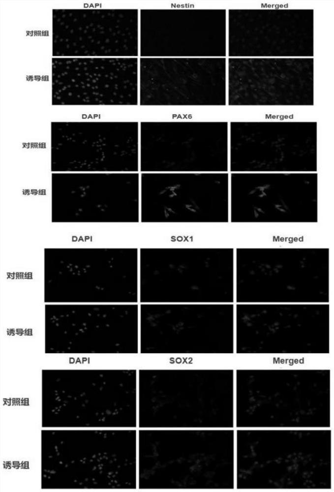 Method for inducing neural stem cells to differentiate into neurons and astrocytes by umbilical cord mesenchymal stem cells