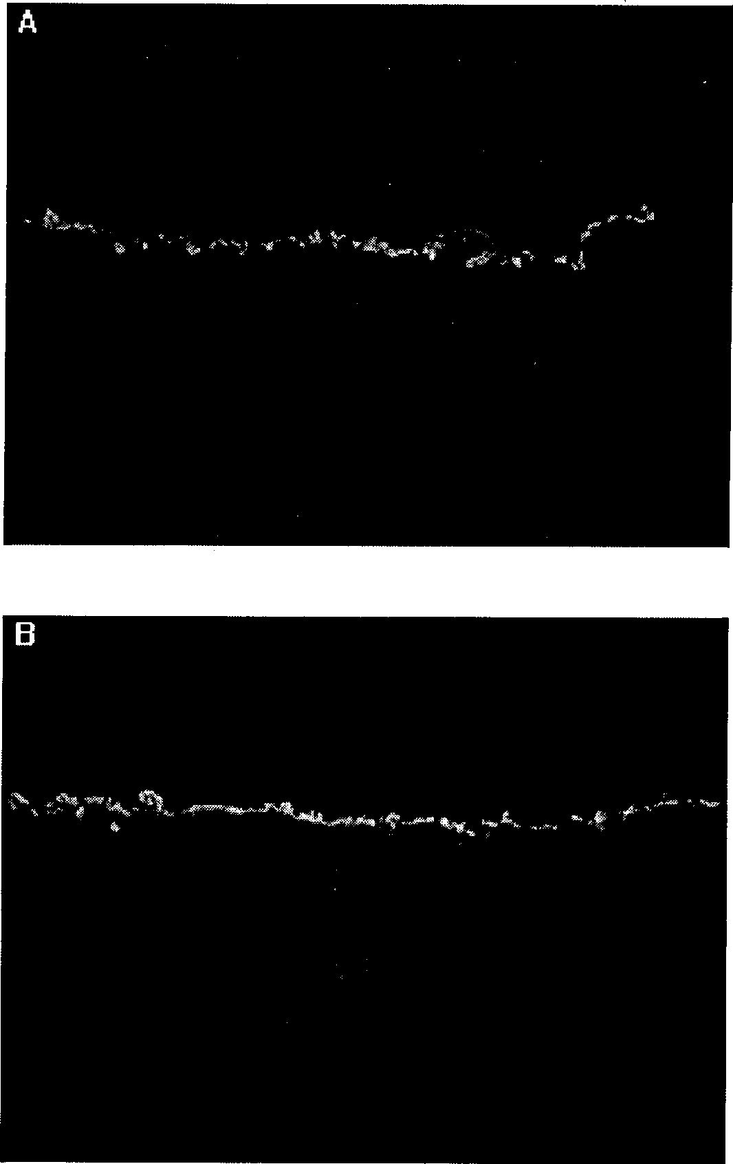 Epidermal growth factor nano lipid vector preparation for skin and preparation method thereof