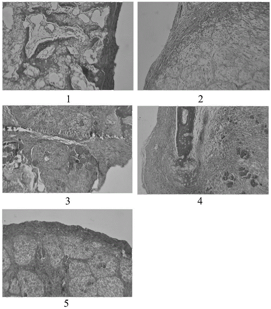 Injectable PLGA (poly(lactic-co-glycolic acid)) porous composite microsphere preparation embedded with BMP-2 and TGF-beta1 containing microspheres as well as preparation method and application of composite microsphere preparation