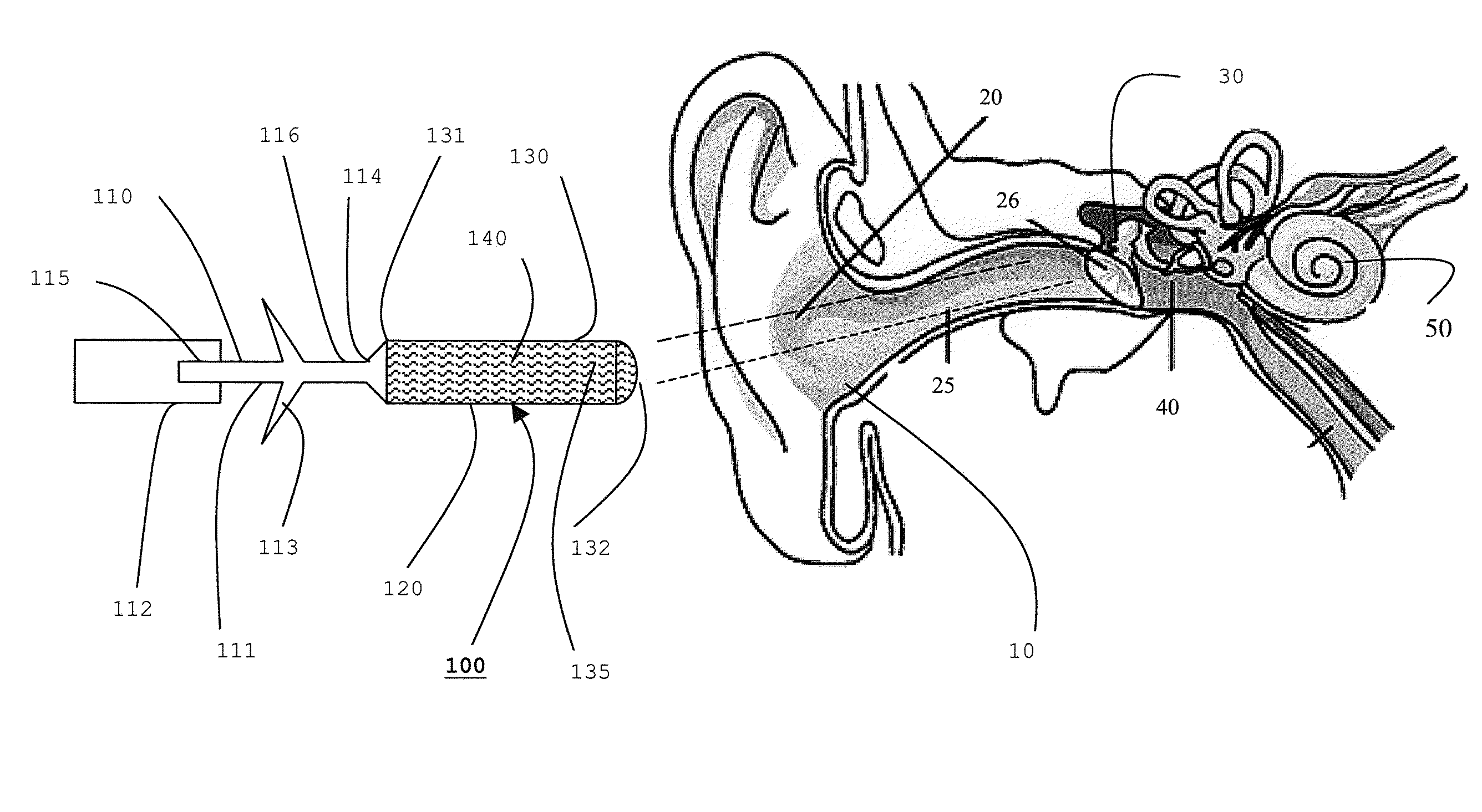 Method for relieving motion sickness and related apparatus