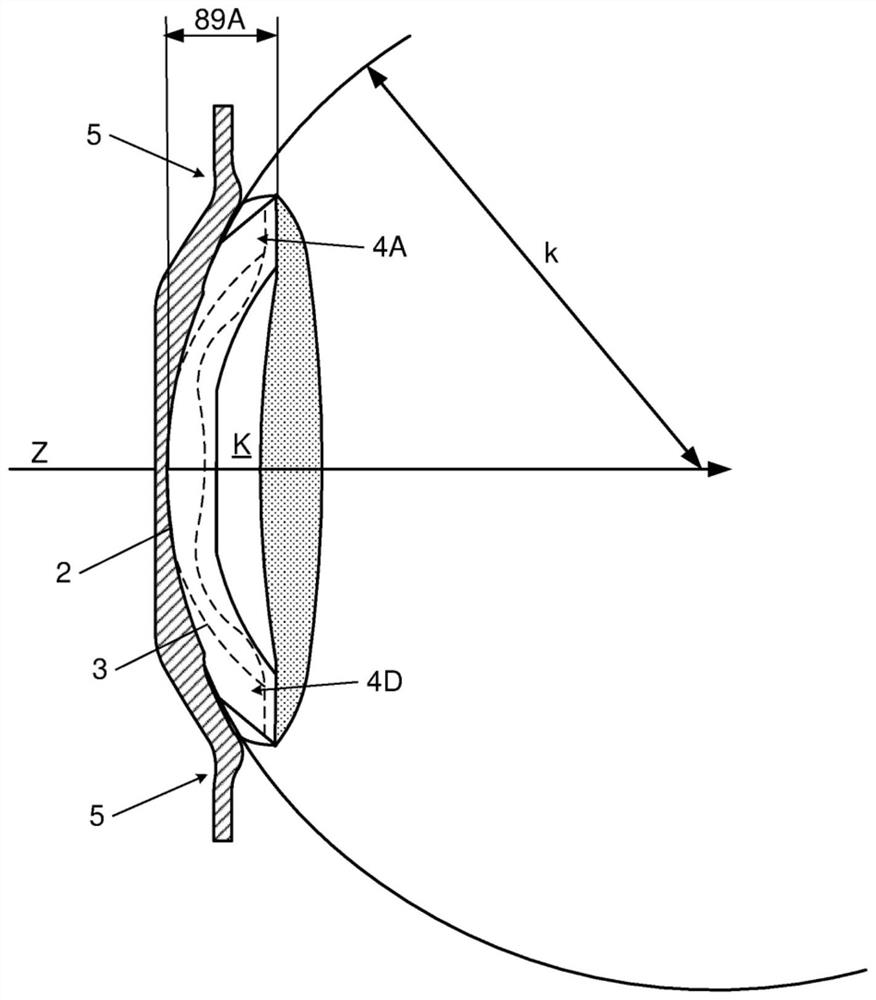 Posterior chamber phakic intraocular lens