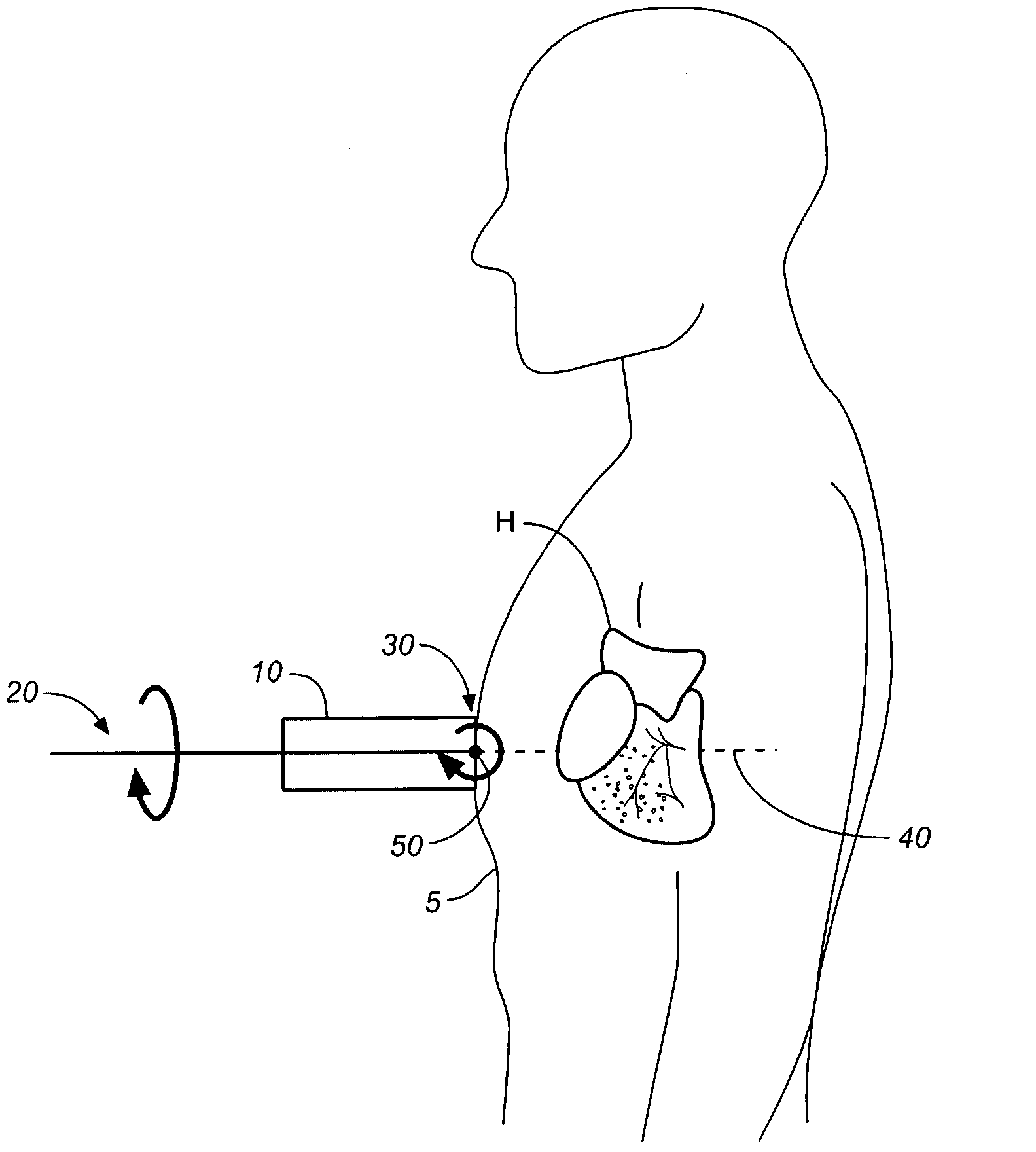 Method and apparatus to visualize the coronary arteries using ultrasound
