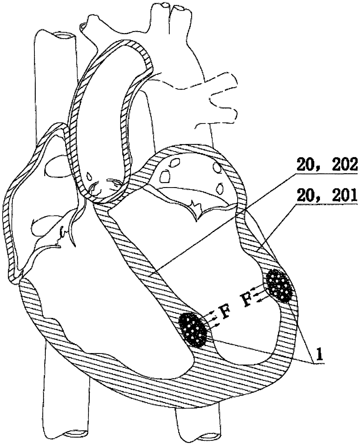 Ventricle assisting device capable of enhancing cardiac functions