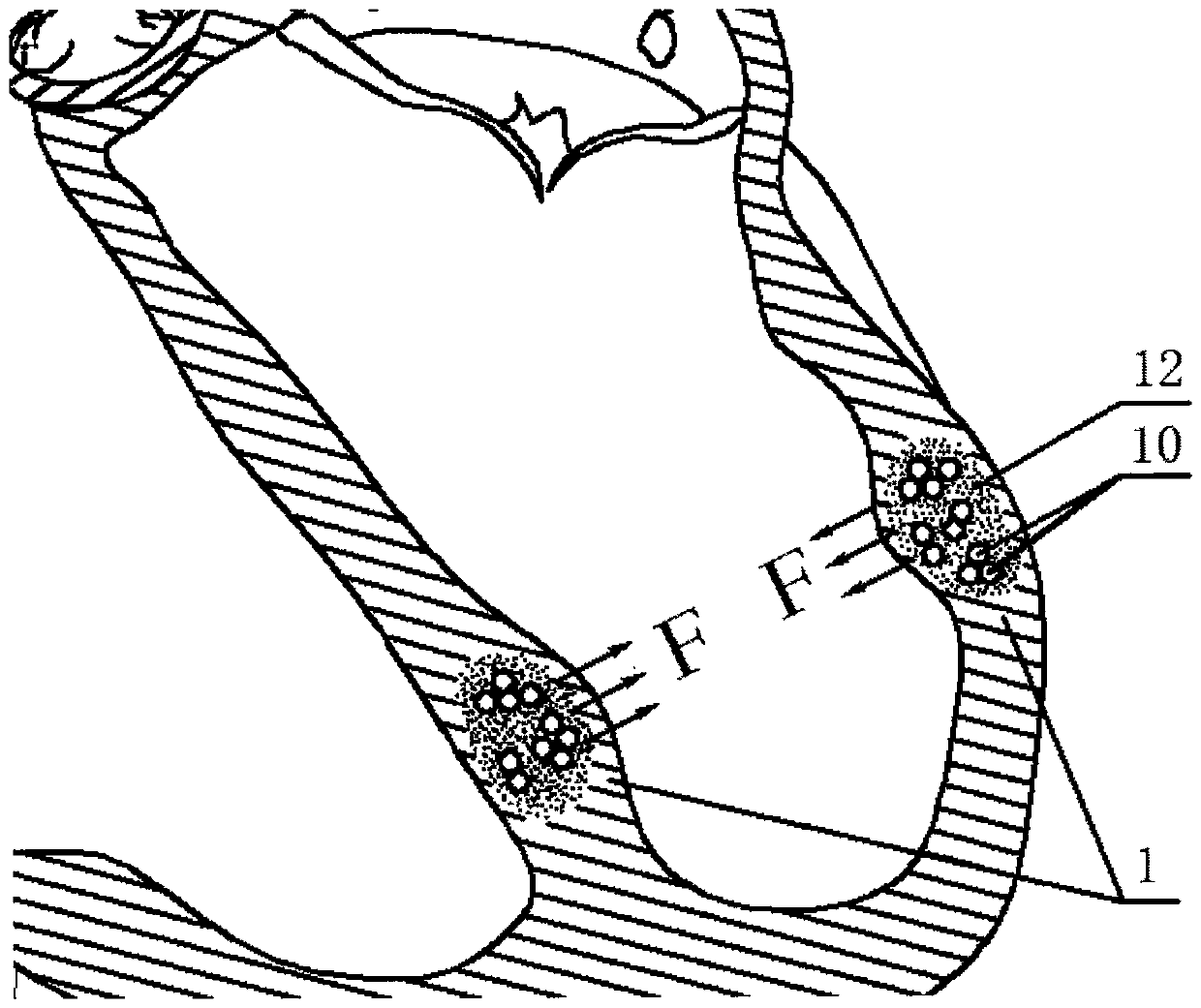 Ventricle assisting device capable of enhancing cardiac functions