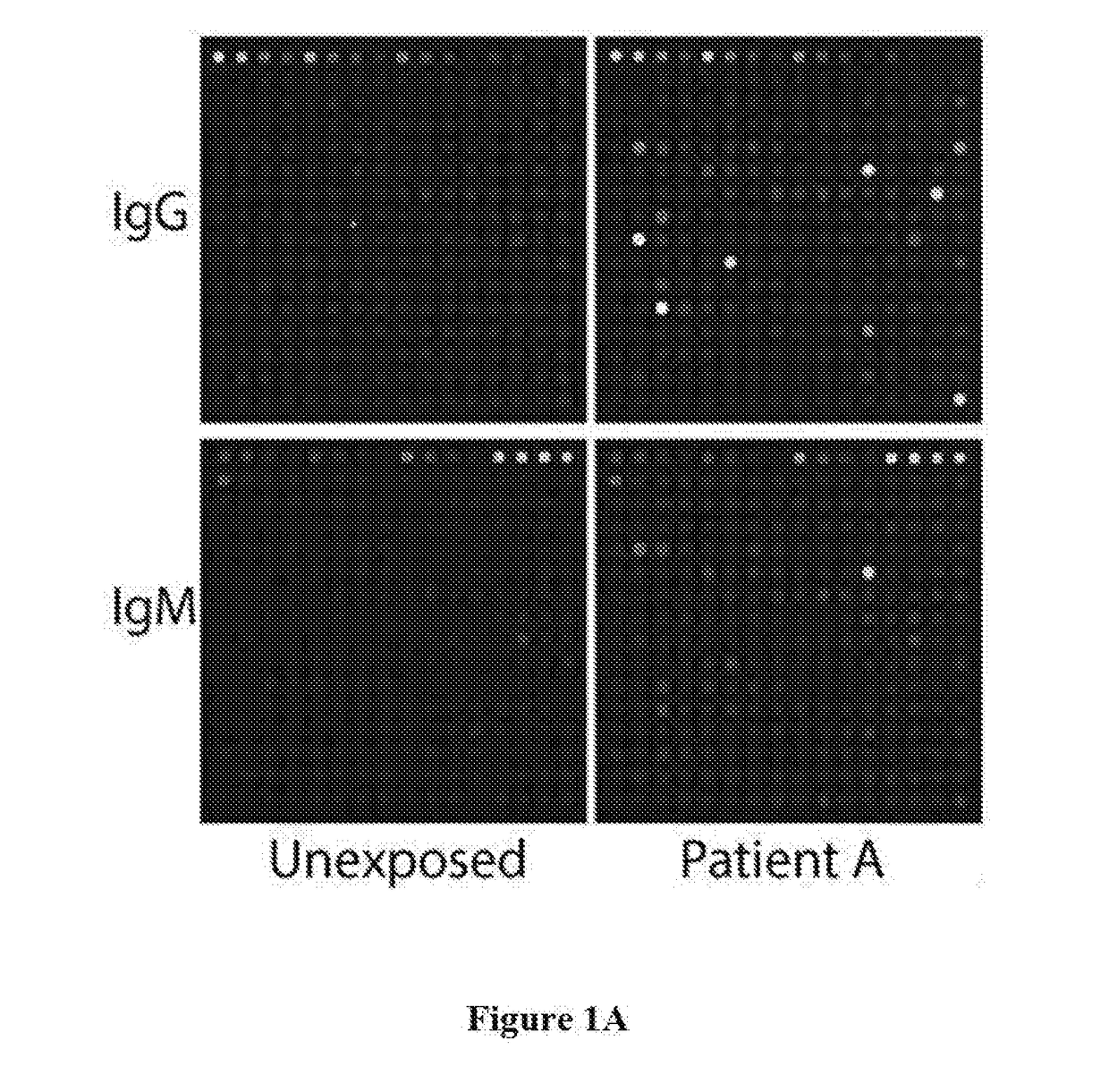 Babesia Biomarkers for Diagnostic and Screening In Vitro Diagnostic Test