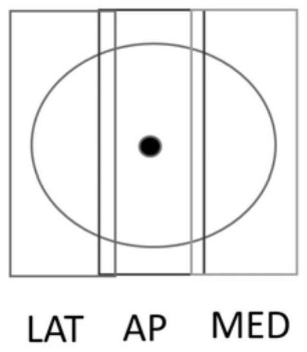 Three-dimensional breast ultrasound scanning method and ultrasound scanning system