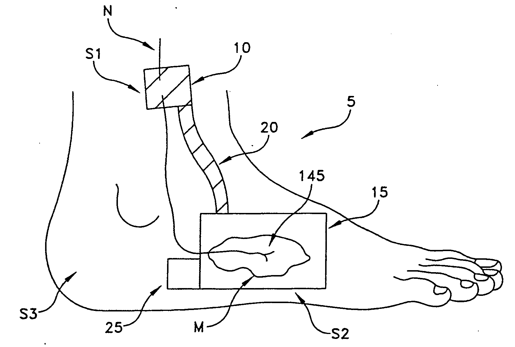 Apparatus and method for performing nerve conduction studies with localization of evoked responses