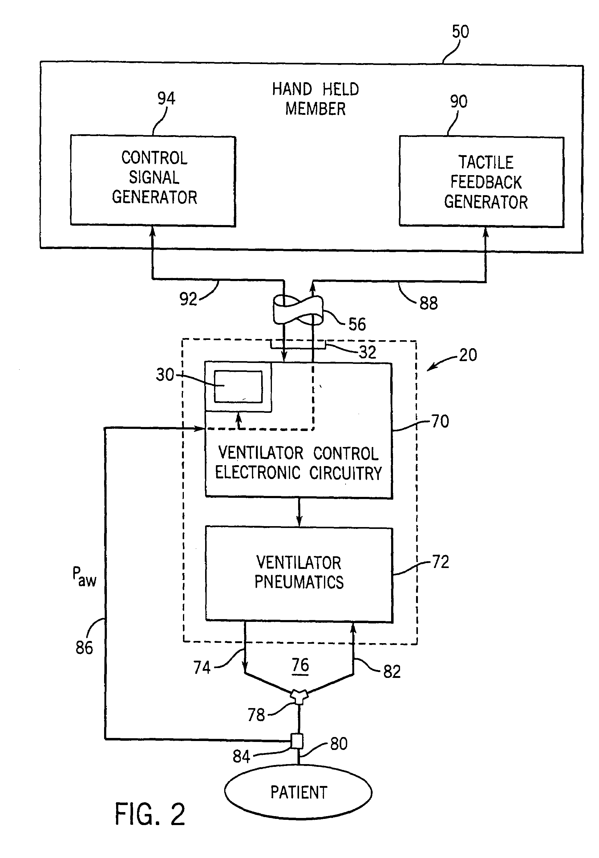 Remote control and tactile feedback system and method for medical apparatus