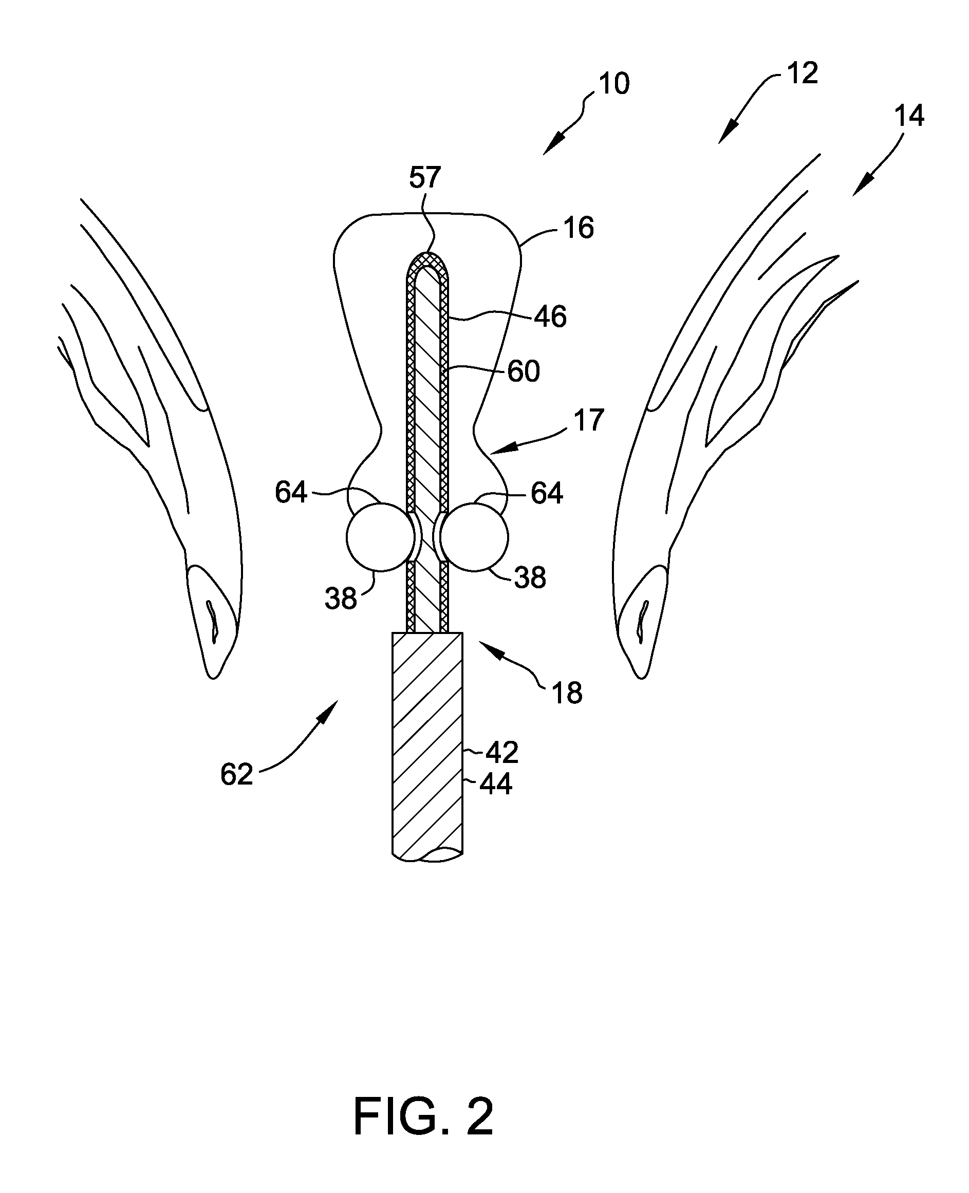 Gynecological brachytherapy applicator for use in mr-guided intracavitary brachytherapy