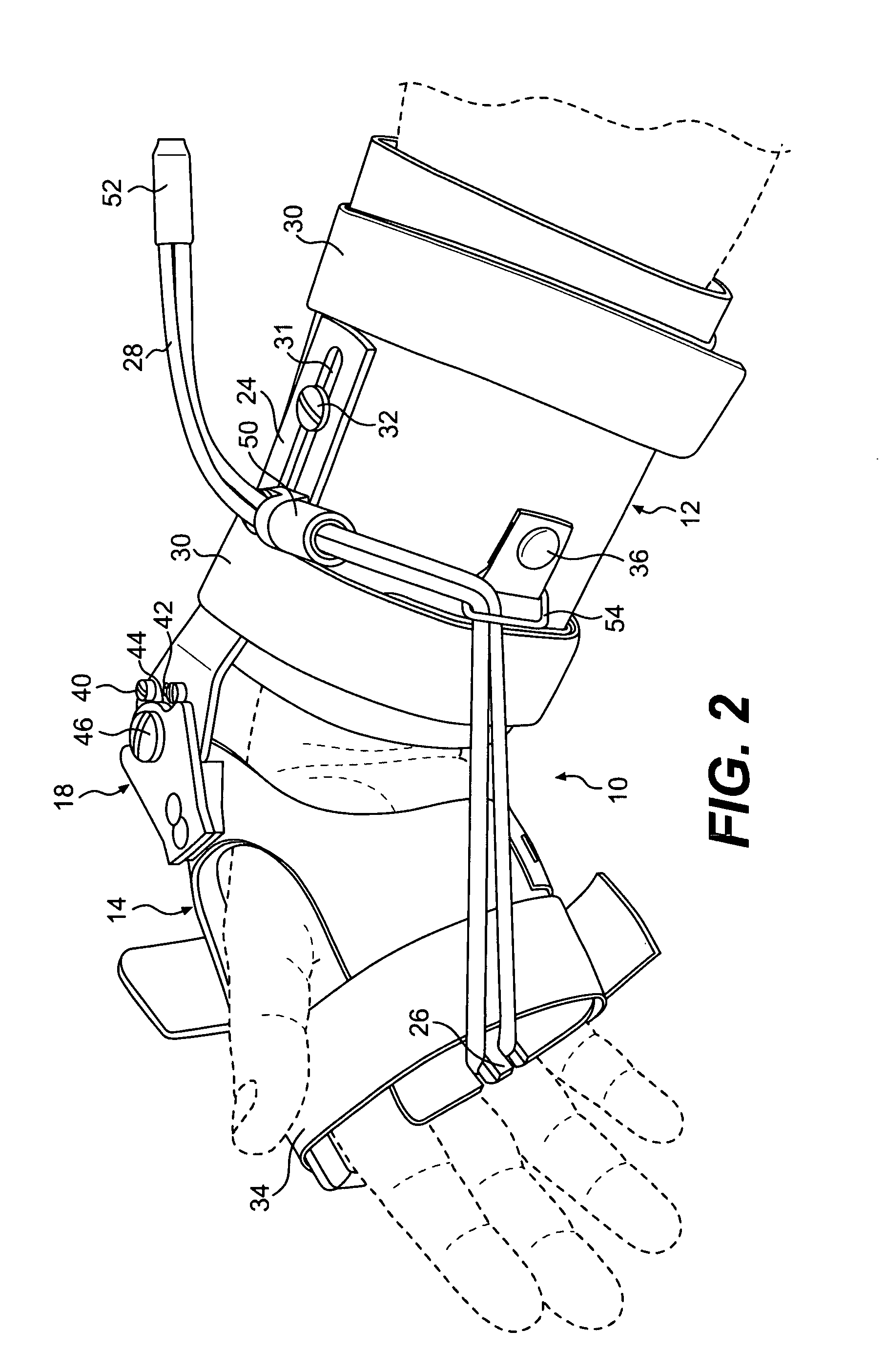 Flexion and extension device
