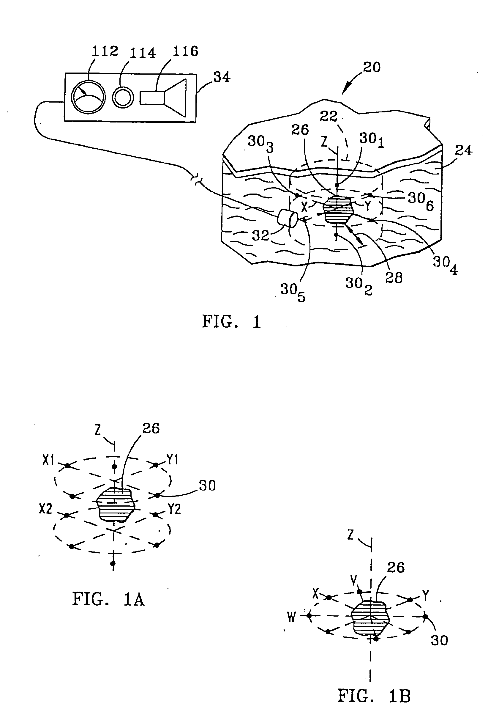 System and method for bracketing and removing tissue