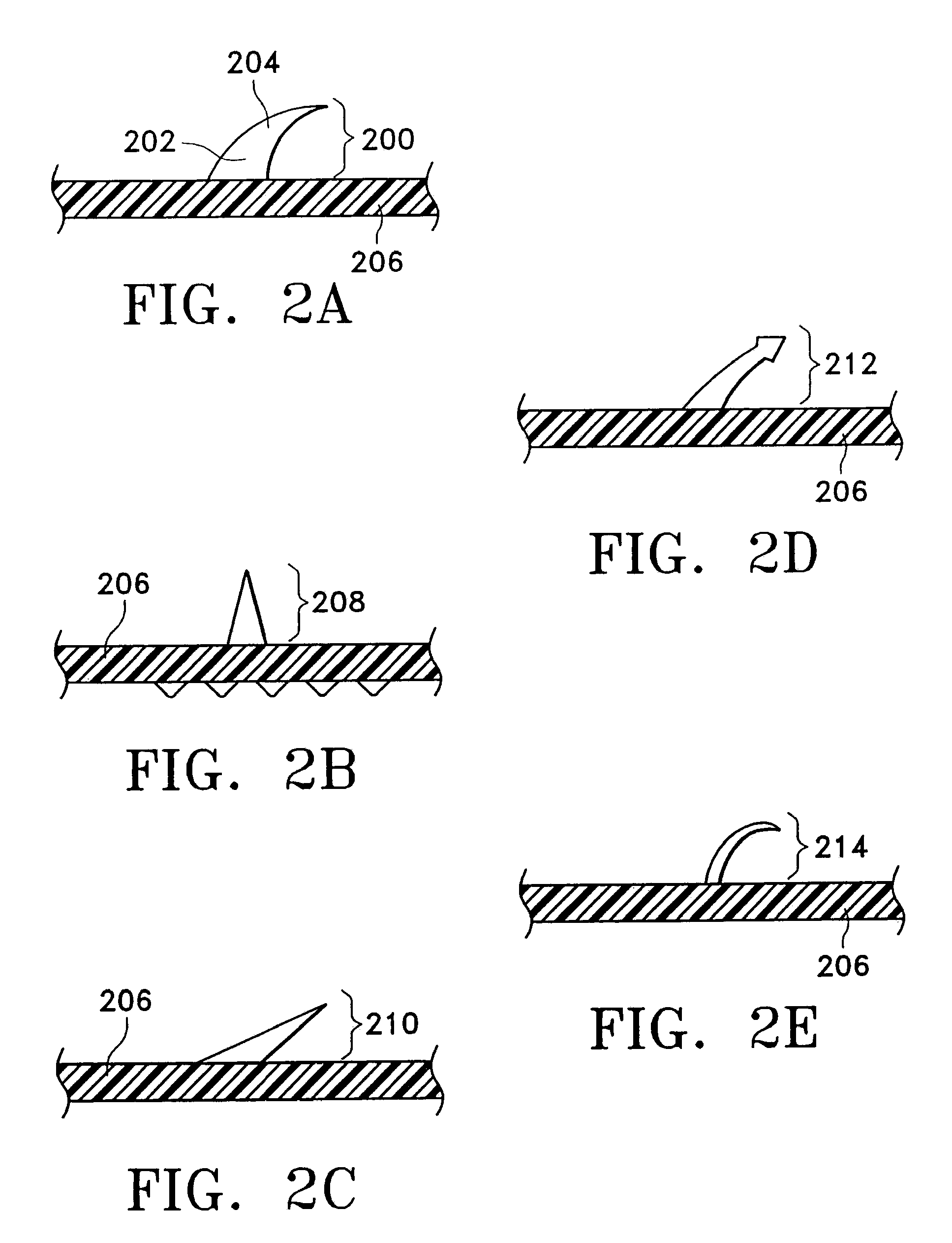 Multi-point tissue tension distribution device and method, a chin lift variation