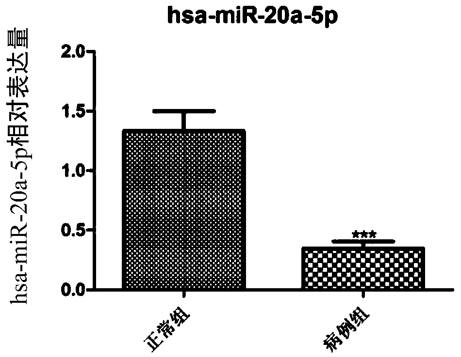 Micro-RNA marker and application thereof