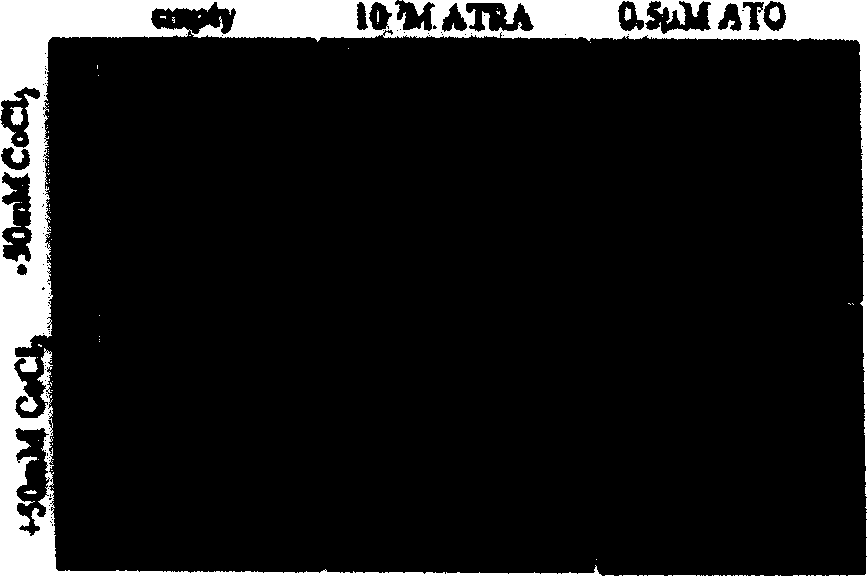 Use of CoCl#-[2] in preparation of drug for treating leukemia