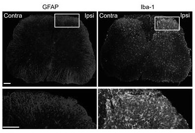 Application of HAP1 in screening neuroinflammation treatment drugs