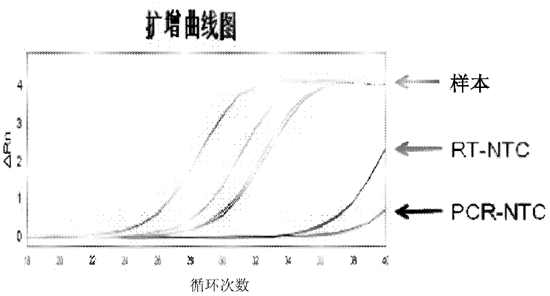 Serum miR-21 (micro-ribonucleic acid-21) detection kit based on luorescence quantitative PCR (polymerase chain reaction) and application thereof