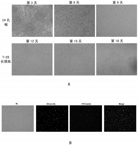 A high-efficiency expansion culture system of non-human primate vascular endothelial progenitor cells