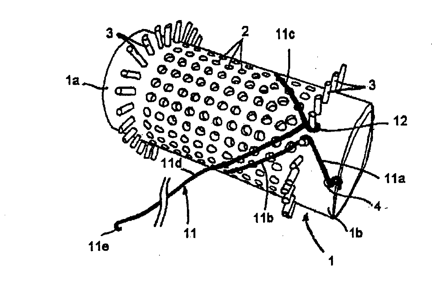 Vascular Stents, Methods of Use and Methods of Manufacture