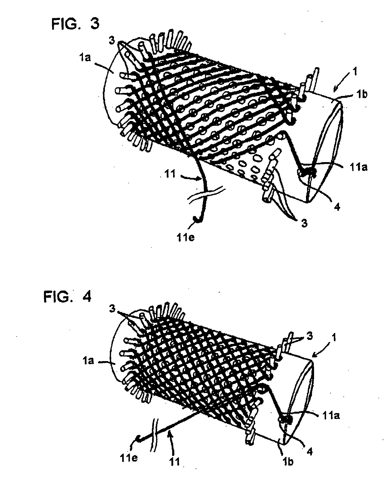 Vascular Stents, Methods of Use and Methods of Manufacture